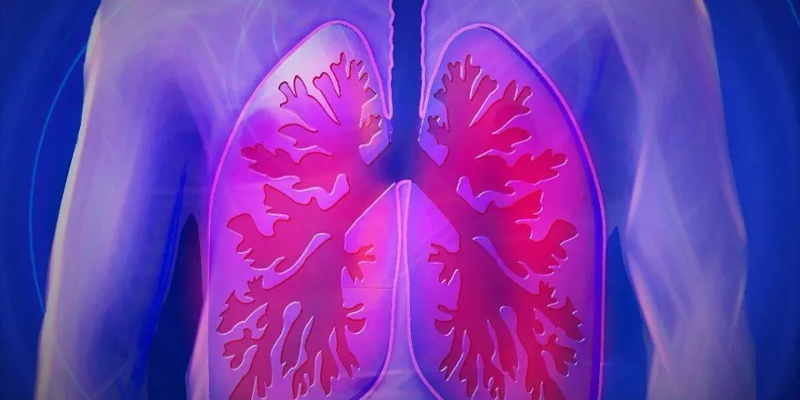 Día mundial de la hipertensión pulmonar, una enfermedad rara que puede ser mortal sin un diagnóstico oportuno