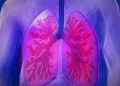 Día mundial de la hipertensión pulmonar, una enfermedad rara que puede ser mortal sin un diagnóstico oportuno