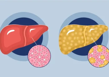 Hígado graso y harinas blancas: cuál es el impacto y por qué hay que evitarlas